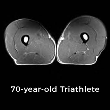 thighs of a 70-year-old triathlete with a healthy body.